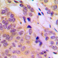 TPL2 (Phospho-T290) Rabbit Polyclonal Antibody