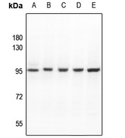 ATF6B Rabbit Polyclonal Antibody