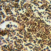 ATF6B Rabbit Polyclonal Antibody