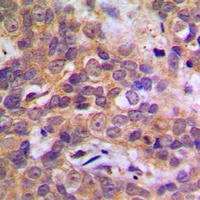 p38 Rabbit Polyclonal Antibody