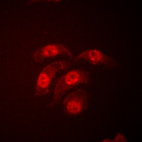 p38 Rabbit Polyclonal Antibody