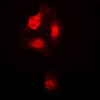 p38 (Phospho-T180) Rabbit Polyclonal Antibody