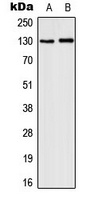 CD131 (Phospho-Y593) Rabbit Polyclonal Antibody