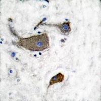 CD131 (Phospho-Y593) Rabbit Polyclonal Antibody