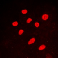 CTBP2 Rabbit Polyclonal Antibody