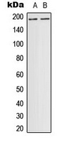 DCC Rabbit Polyclonal Antibody