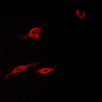 DCC Rabbit Polyclonal Antibody