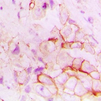 CD143 Rabbit Polyclonal Antibody