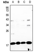 GADD153 Rabbit Polyclonal Antibody
