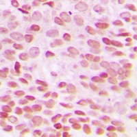GADD153 Rabbit Polyclonal Antibody