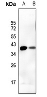 DUSP1 Rabbit Polyclonal Antibody