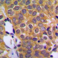 DUSP1 Rabbit Polyclonal Antibody