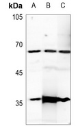 Estrogen Receptor alpha Rabbit Polyclonal Antibody