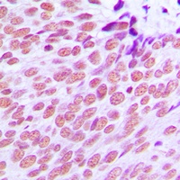 Estrogen Receptor alpha Rabbit Polyclonal Antibody