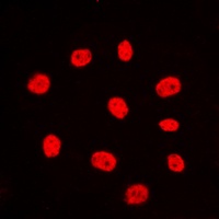Estrogen Receptor alpha Rabbit Polyclonal Antibody
