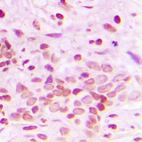 Ku70 Rabbit Polyclonal Antibody