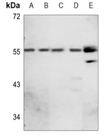 GABRA1 Rabbit Polyclonal Antibody