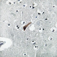 GABRA1 Rabbit Polyclonal Antibody