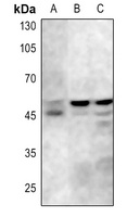GSK3 alpha/beta (Phospho-Y279/216) Rabbit Polyclonal Antibody