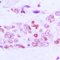 GSK3 alpha/beta (Phospho-Y279/216) Rabbit Polyclonal Antibody