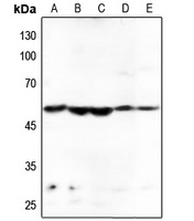 HARS Rabbit Polyclonal Antibody