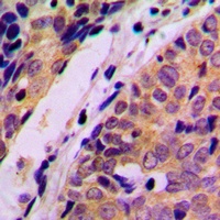 HARS Rabbit Polyclonal Antibody