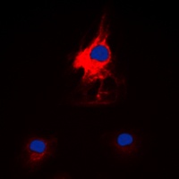 HARS Rabbit Polyclonal Antibody