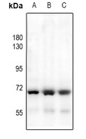 HEXB Rabbit Polyclonal Antibody