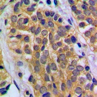 HEXB Rabbit Polyclonal Antibody