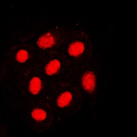 HNF4 alpha (Phospho-S313) Rabbit Polyclonal Antibody
