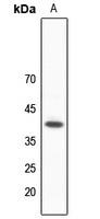 hNRNP C Rabbit Polyclonal Antibody
