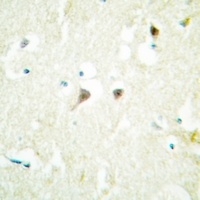 hNRNP C Rabbit Polyclonal Antibody