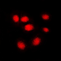 hNRNP C Rabbit Polyclonal Antibody