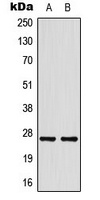 HSP27 Rabbit Polyclonal Antibody