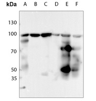 HSP90 beta (Phospho-S254) Rabbit Polyclonal Antibody