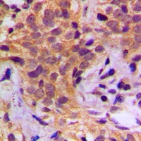 HSP90 beta (Phospho-S254) Rabbit Polyclonal Antibody