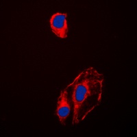 HSP90 beta (Phospho-S254) Rabbit Polyclonal Antibody