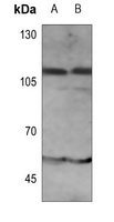 IFNAR1 (Phospho-Y466) Rabbit Polyclonal Antibody