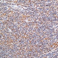 IL-10 Rabbit Polyclonal Antibody