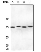 IRF4 Rabbit Polyclonal Antibody