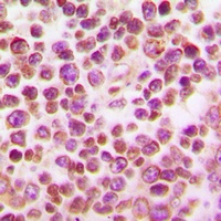 IRF4 Rabbit Polyclonal Antibody
