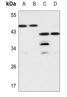 Galectin 8 Rabbit Polyclonal Antibody