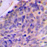 Galectin 8 Rabbit Polyclonal Antibody