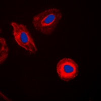 Galectin 8 Rabbit Polyclonal Antibody