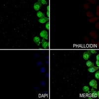 TAU (Phospho-T498) Rabbit Polyclonal Antibody