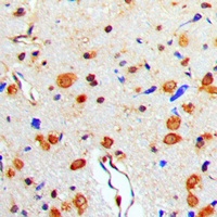 TAU (Phospho-T529) Rabbit Polyclonal Antibody