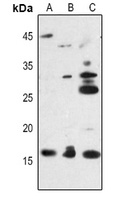Midkine Rabbit Polyclonal Antibody