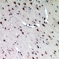 Midkine Rabbit Polyclonal Antibody