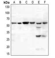 MDM2 (Phospho-S166) Rabbit Polyclonal Antibody