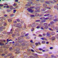 MDM2 (Phospho-S166) Rabbit Polyclonal Antibody